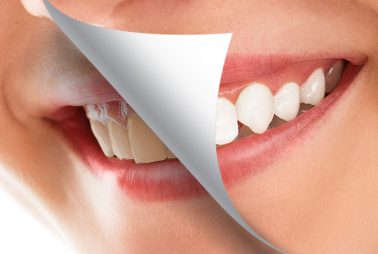 Restorative Dentist Consultation in Oman