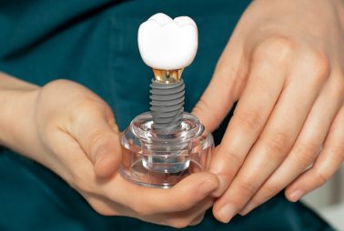 Best Dental Implants Treatments in Oman