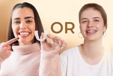 Invisalign or Braces: Which Treatment is Faster?